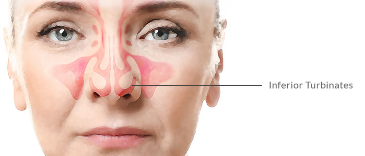 Snoring and Sleep Apnea